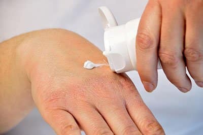 A person squirts lotion on their dry hand