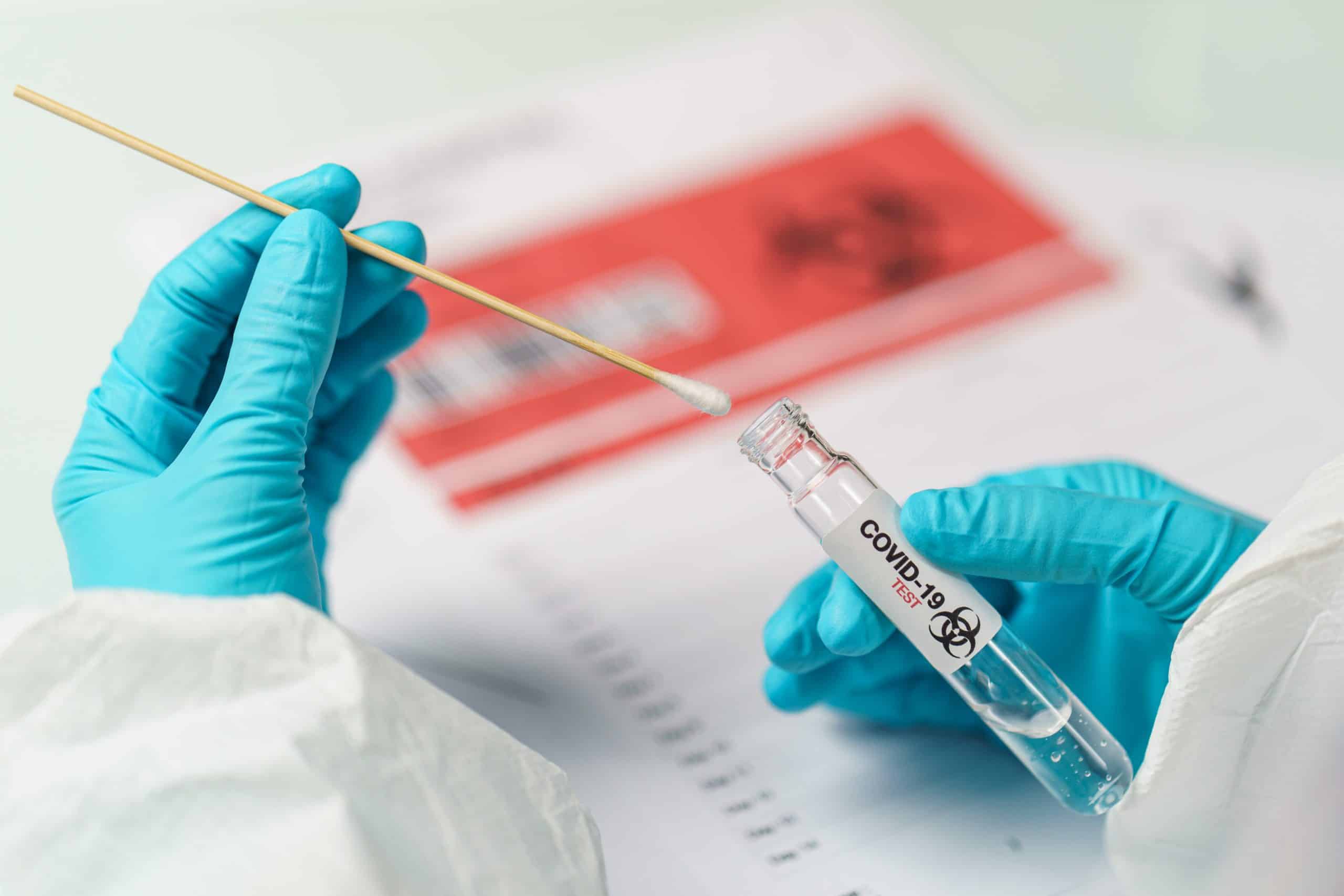 a doctor tests a vial for covid