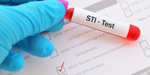 a doctor conducts an STI test